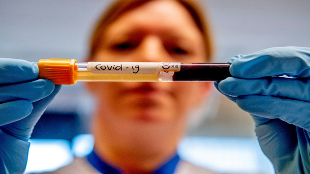 Nuevo récord de infectados de coronavirus en Escobar, con 36 casos en un día