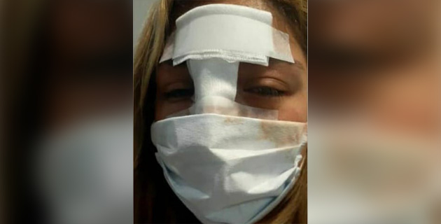 Violencia escolar: Alumno agredió a una docente y casi le arranca un ojo