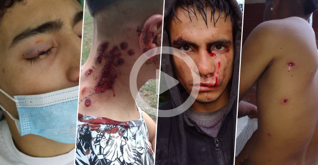 Grave denuncia de violencia policial en Loma Verde: 11 adolescentes heridos