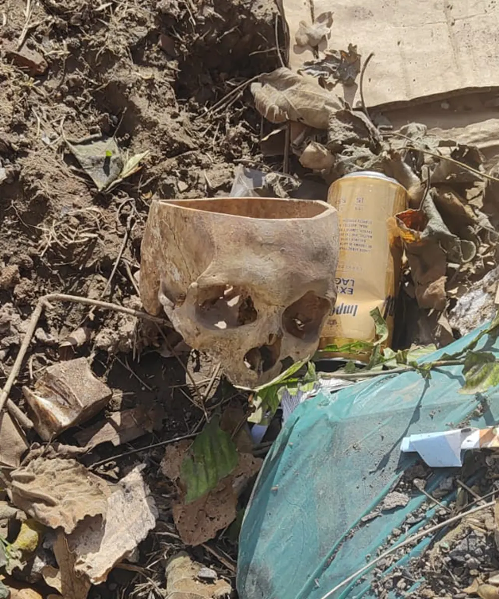 Cráneo encontrado entre la basura