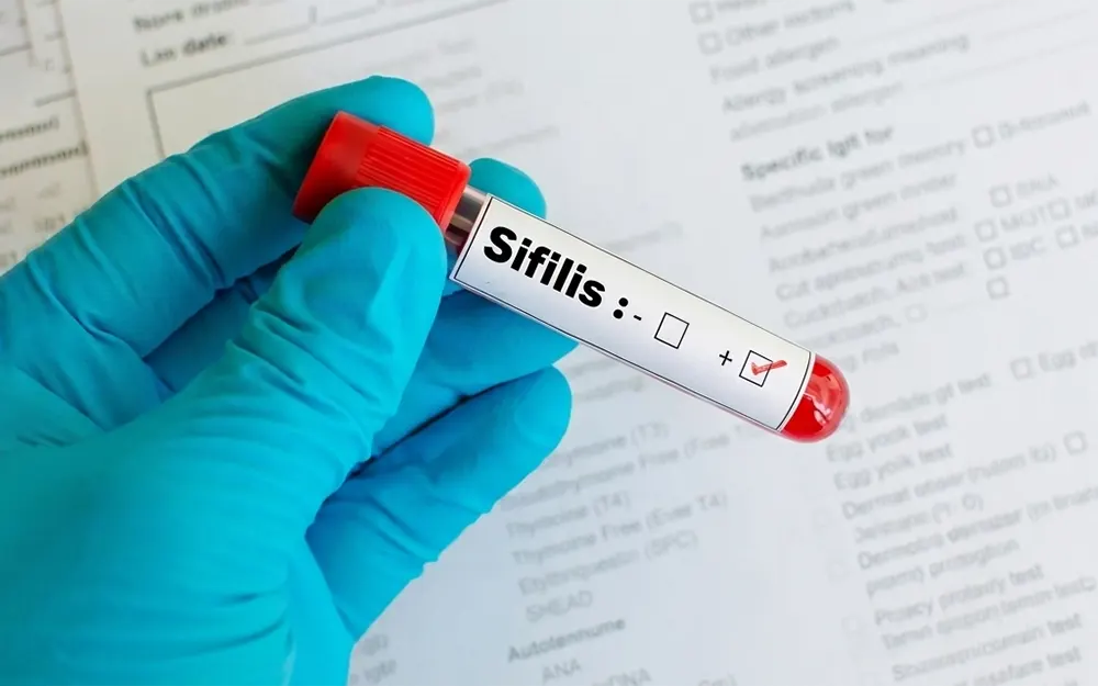 Escobar refuerza los testeos de sífilis ante el aumento de casos en el país